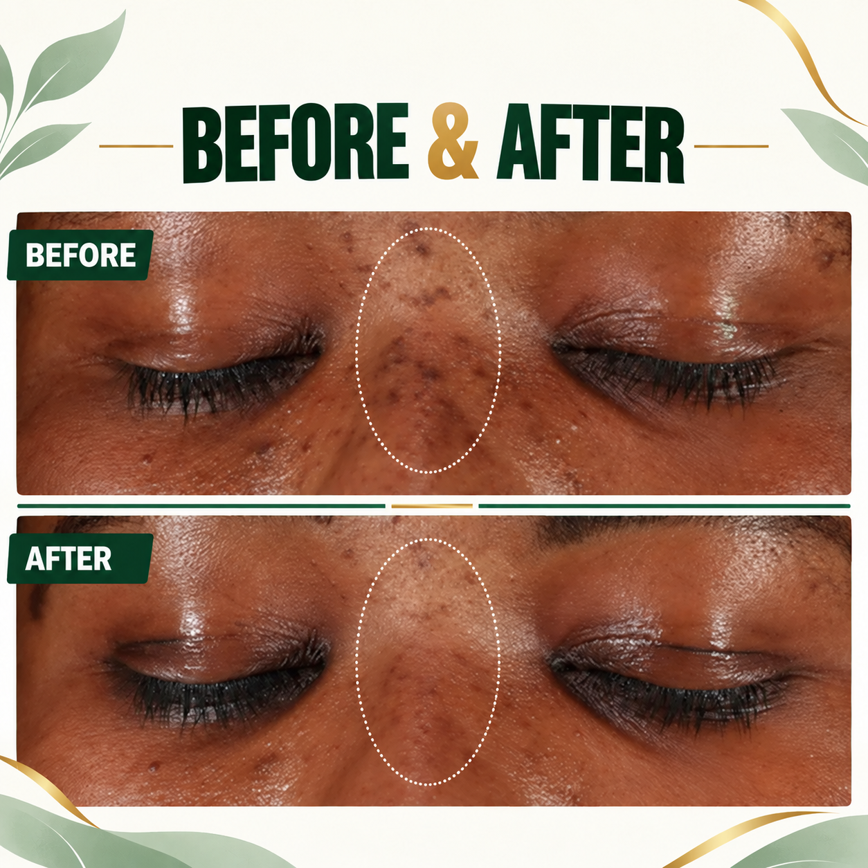 DARK SPOT SERUM