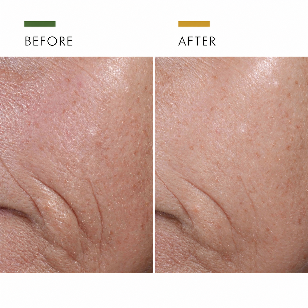 ANTI AGING MOISTURIZER
