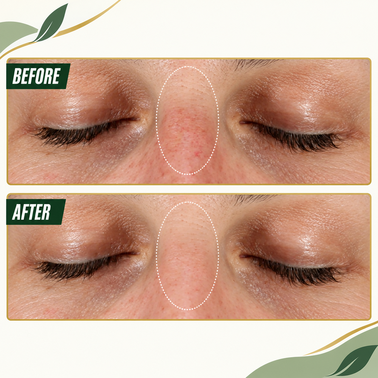 DARK SPOT SERUM